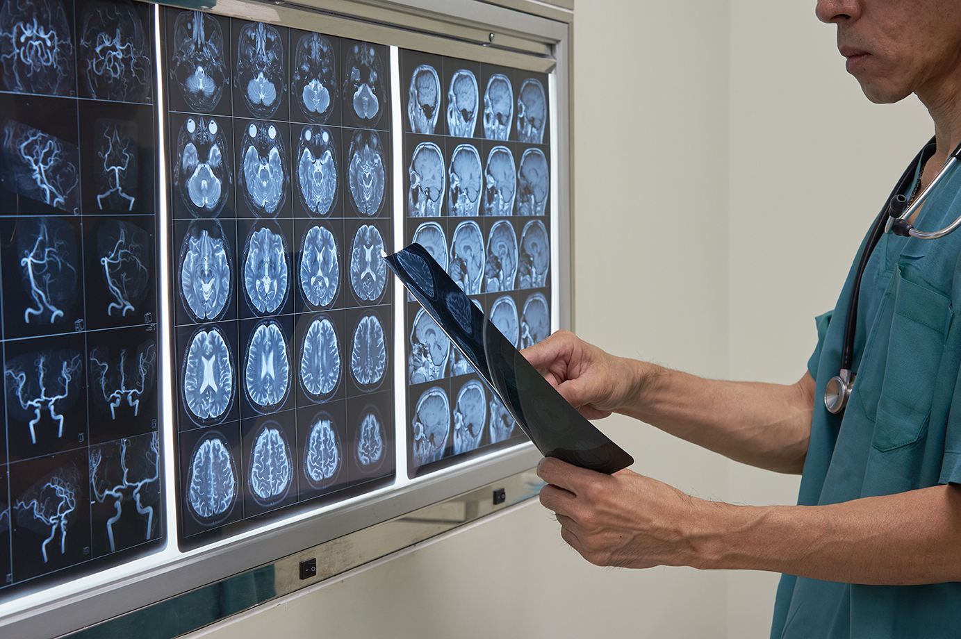 Doctor looking at MRI film of human brain